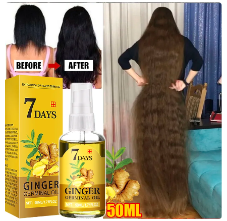 Wholesale prices with free shipping all over United States Fast Hair Growth Men Women Ginger Growth Hair Oil Treatment Anti Hair Loss Scalp Treatment Serum Products Beauty Health - Steven Deals