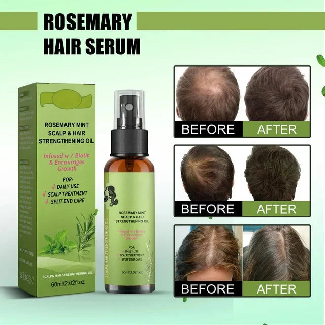 Wholesale prices with free shipping all over United States Hair Growth Rosemary Spray Plant Organic Rosemary Essential Oil Rosemary Oil For Hair Skin Refreshing Hair Growth Oil For Enhanced Shine fabulous - Steven Deals